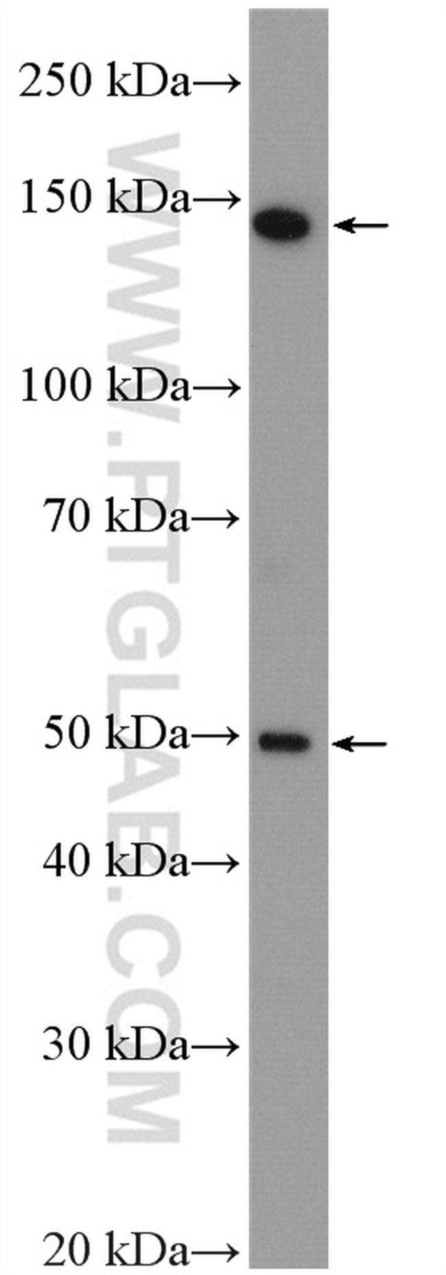 MED23 Antibody in Western Blot (WB)