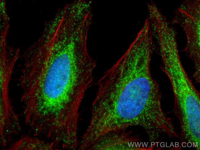 YME1L1 Antibody in Immunocytochemistry (ICC/IF)