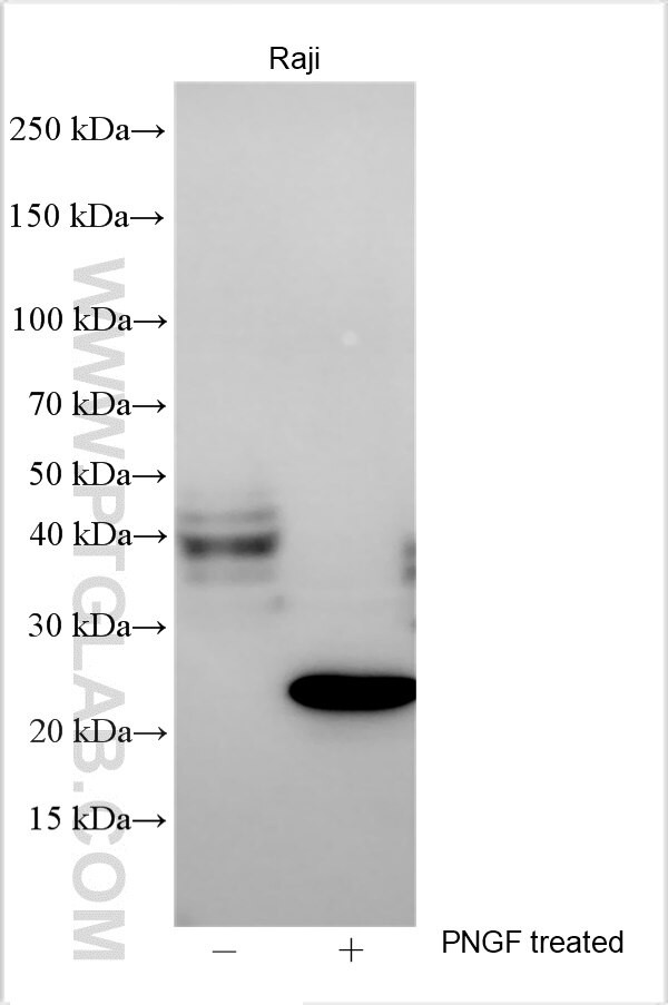 OSBPL5 Antibody in Western Blot (WB)