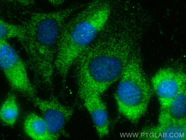 Endothelin 3 Antibody in Immunocytochemistry (ICC/IF)
