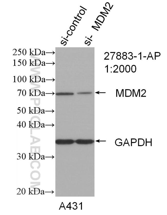 MDM2 Antibody in Western Blot (WB)