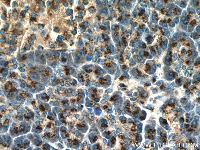PRRC1 Antibody in Immunohistochemistry (Paraffin) (IHC (P))