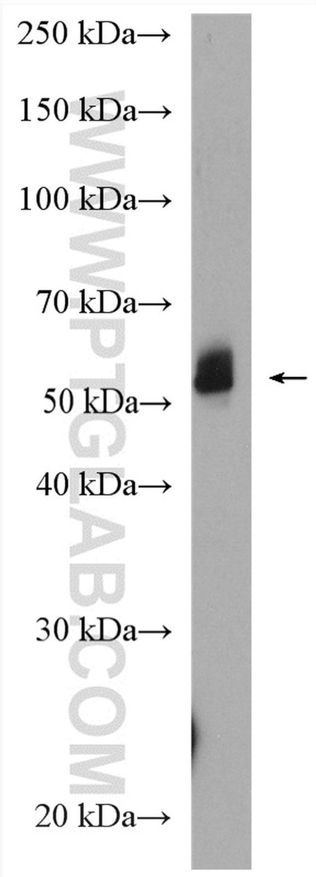 NAP1L4 Antibody in Western Blot (WB)