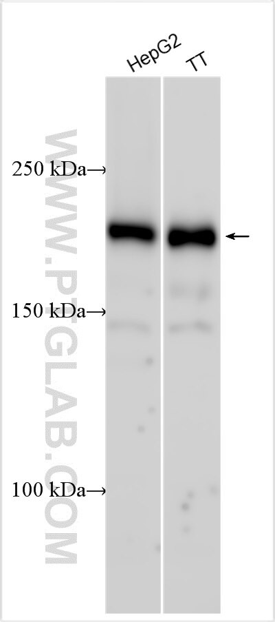 UBE2J1 Antibody in Western Blot (WB)