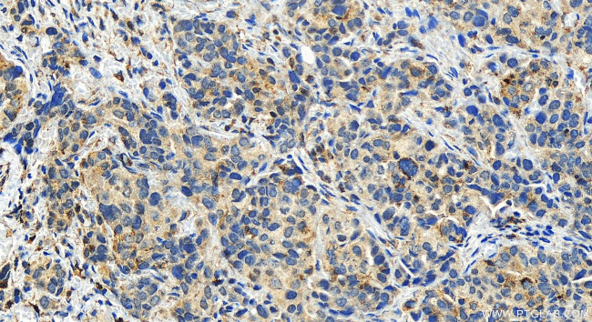 LACC1 Antibody in Immunohistochemistry (Paraffin) (IHC (P))