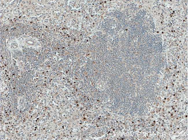 NLRP7 Antibody in Immunohistochemistry (Paraffin) (IHC (P))
