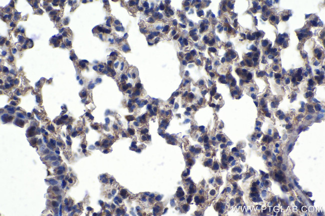 MERTK Antibody in Immunohistochemistry (Paraffin) (IHC (P))