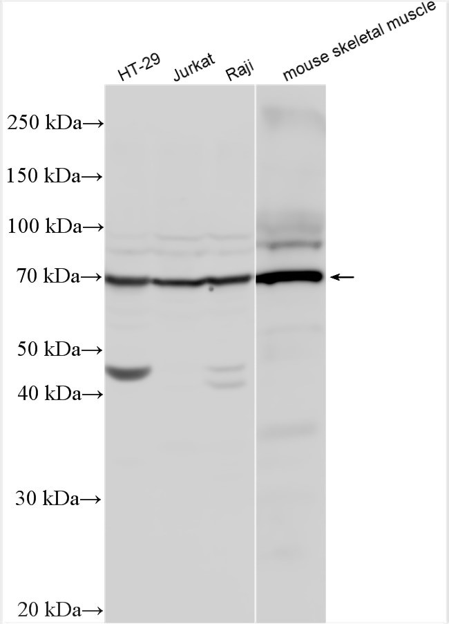 IL-13Ra1 Antibody in Western Blot (WB)