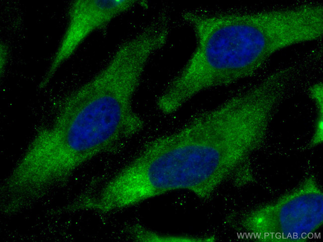 CYFIP1 Antibody in Immunocytochemistry (ICC/IF)
