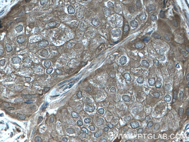 C19orf62 Antibody in Immunohistochemistry (Paraffin) (IHC (P))
