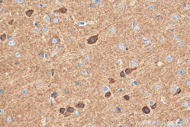 GABRA5 Antibody in Immunohistochemistry (Paraffin) (IHC (P))