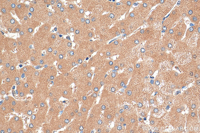PTPRD Antibody in Immunohistochemistry (Paraffin) (IHC (P))