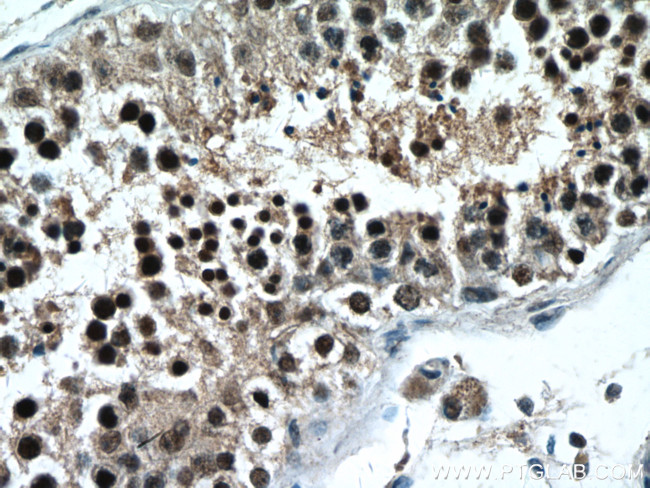 PAK6 Antibody in Immunohistochemistry (Paraffin) (IHC (P))