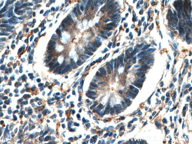 EIF2AK4 Antibody in Immunohistochemistry (Paraffin) (IHC (P))
