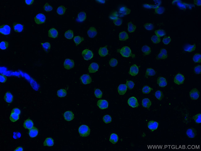 CD19 Antibody in Immunocytochemistry (ICC/IF)