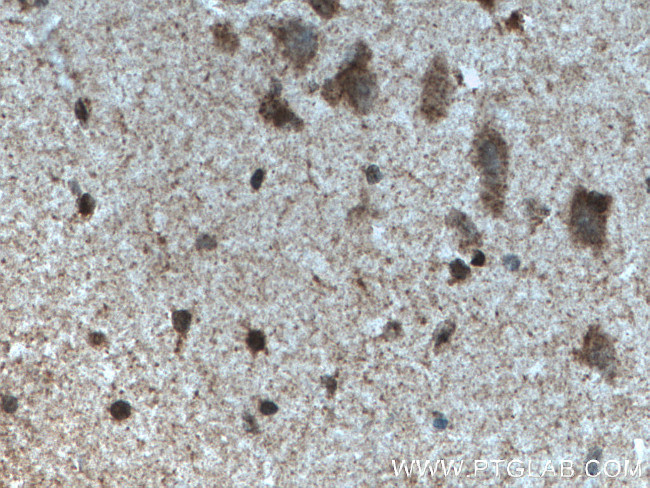 MYCBP2 Antibody in Immunohistochemistry (Paraffin) (IHC (P))
