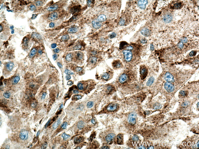 Cathepsin L Antibody in Immunohistochemistry (Paraffin) (IHC (P))