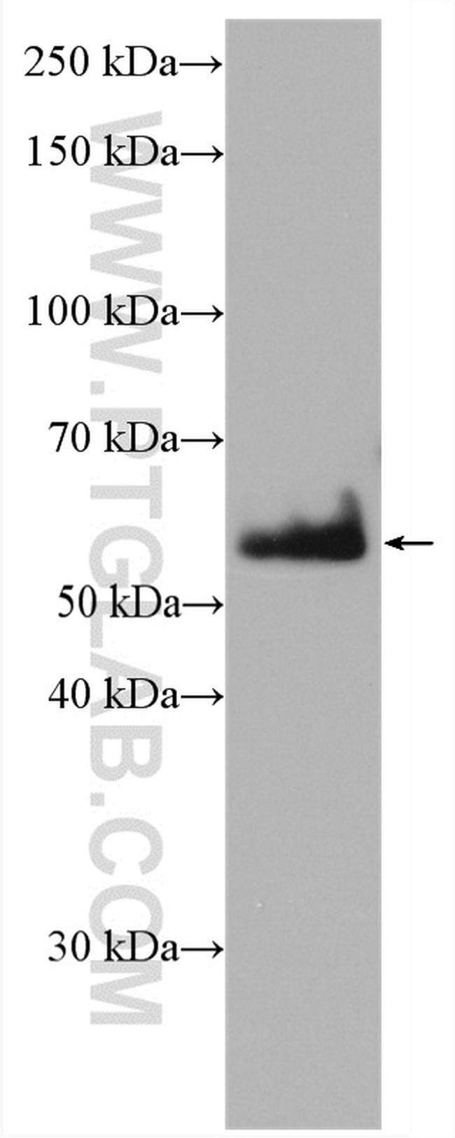 CDSN Antibody in Western Blot (WB)