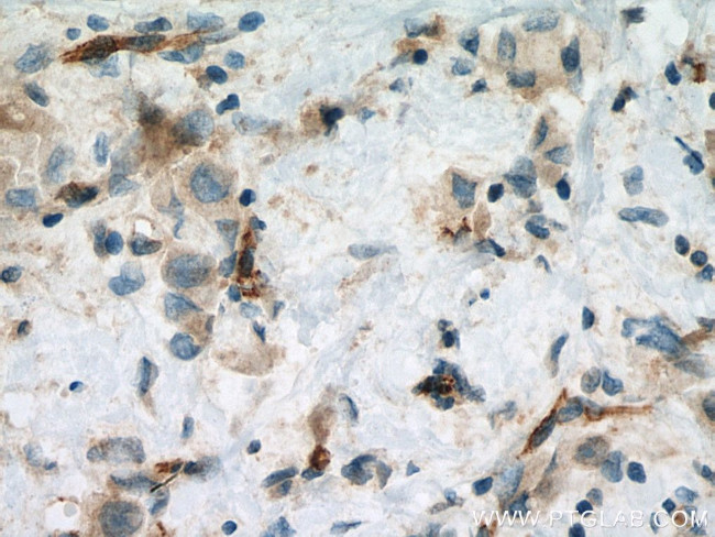 VE-cadherin Antibody in Immunohistochemistry (Paraffin) (IHC (P))