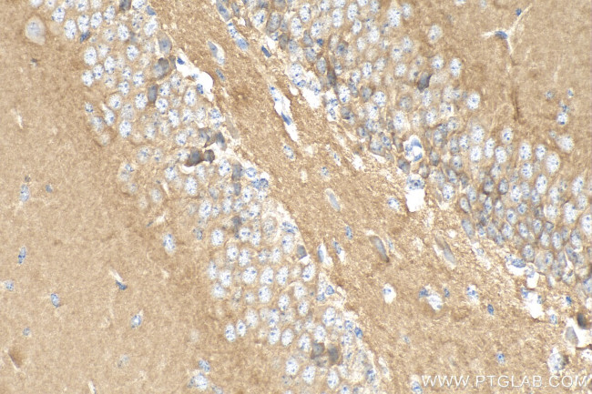 PHF24 Antibody in Immunohistochemistry (Paraffin) (IHC (P))