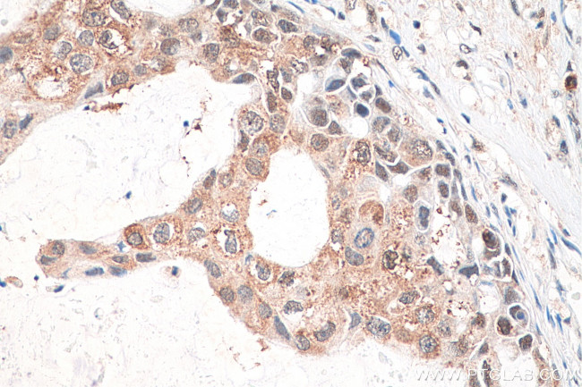CXXC1 Antibody in Immunohistochemistry (Paraffin) (IHC (P))