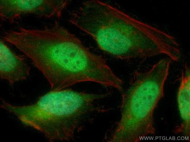 CAMKMT Antibody in Immunocytochemistry (ICC/IF)