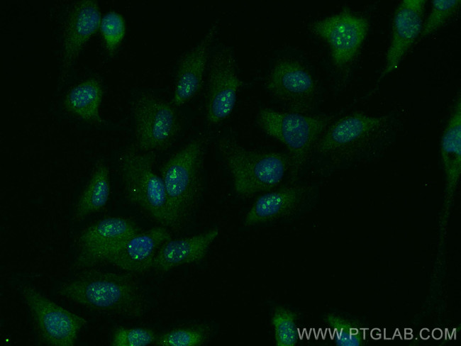 PPP1R17 Antibody in Immunocytochemistry (ICC/IF)