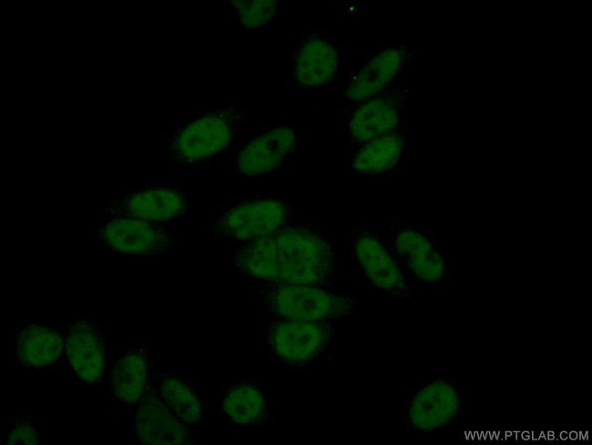 NOSIP Antibody in Immunocytochemistry (ICC/IF)