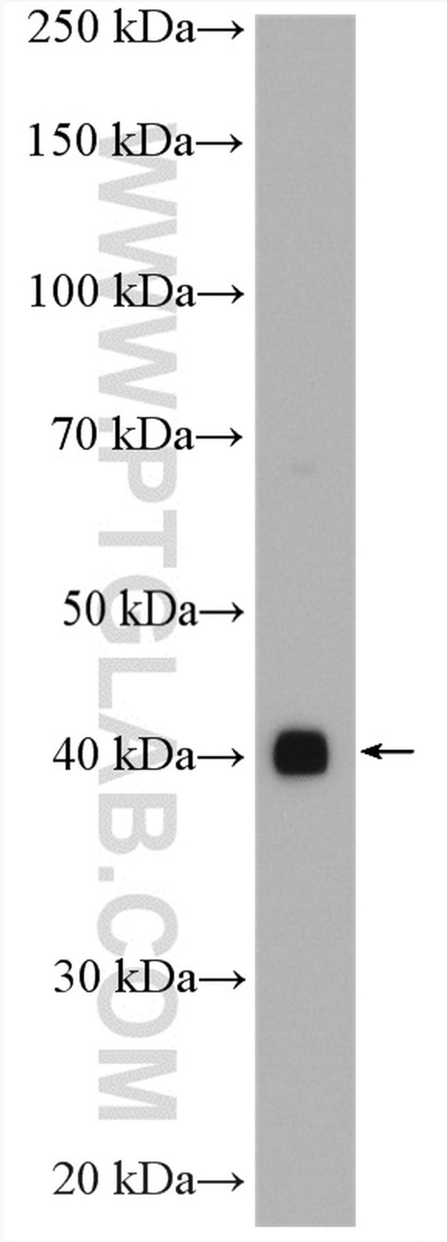 FAM71F1 Antibody in Western Blot (WB)