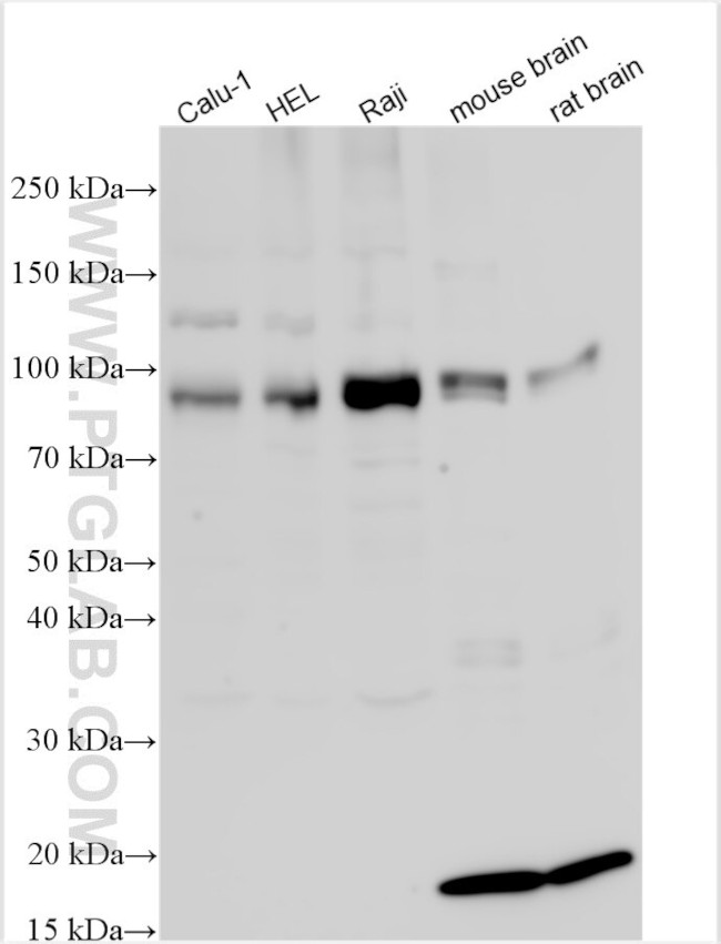 RBMXL2 Antibody in Western Blot (WB)