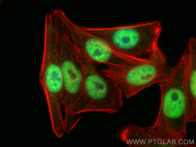 TOX4 Antibody in Immunocytochemistry (ICC/IF)