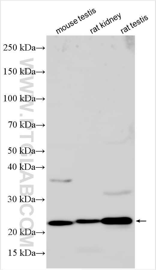 KCNQ5 Antibody in Western Blot (WB)