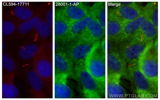 ARMC9 Antibody in Immunocytochemistry (ICC/IF)