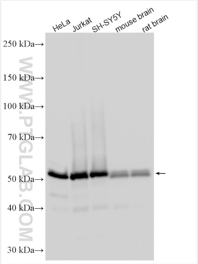 PABPN1 Antibody in Western Blot (WB)
