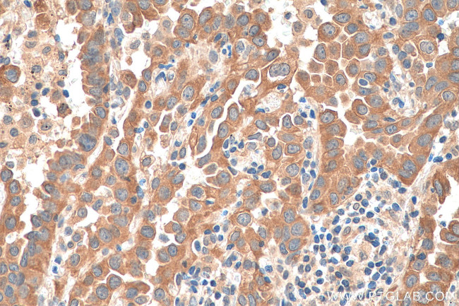 TUBG2 Antibody in Immunohistochemistry (Paraffin) (IHC (P))