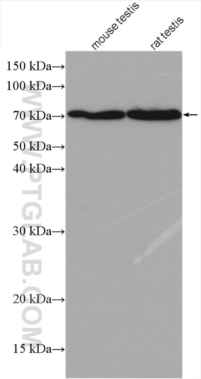 SPESP1 Antibody in Western Blot (WB)