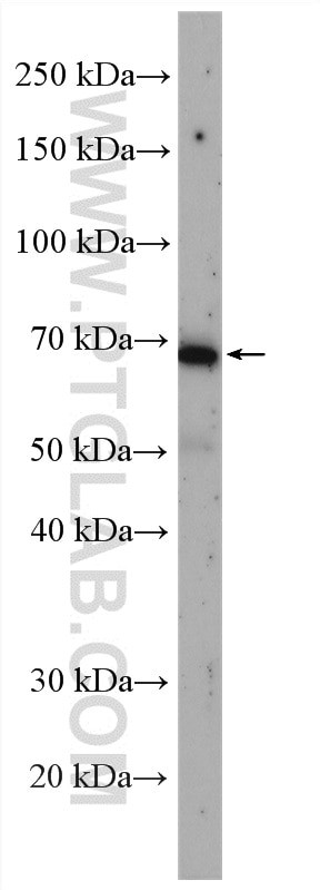 C19orf26 Antibody in Western Blot (WB)