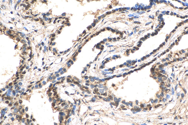 ZFPM1 Antibody in Immunohistochemistry (Paraffin) (IHC (P))