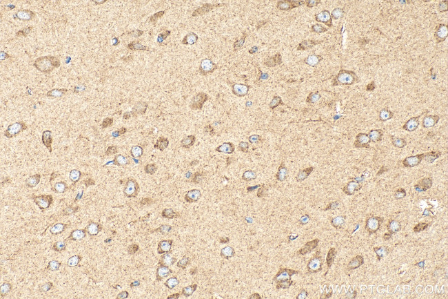 CRB2 Antibody in Immunohistochemistry (Paraffin) (IHC (P))