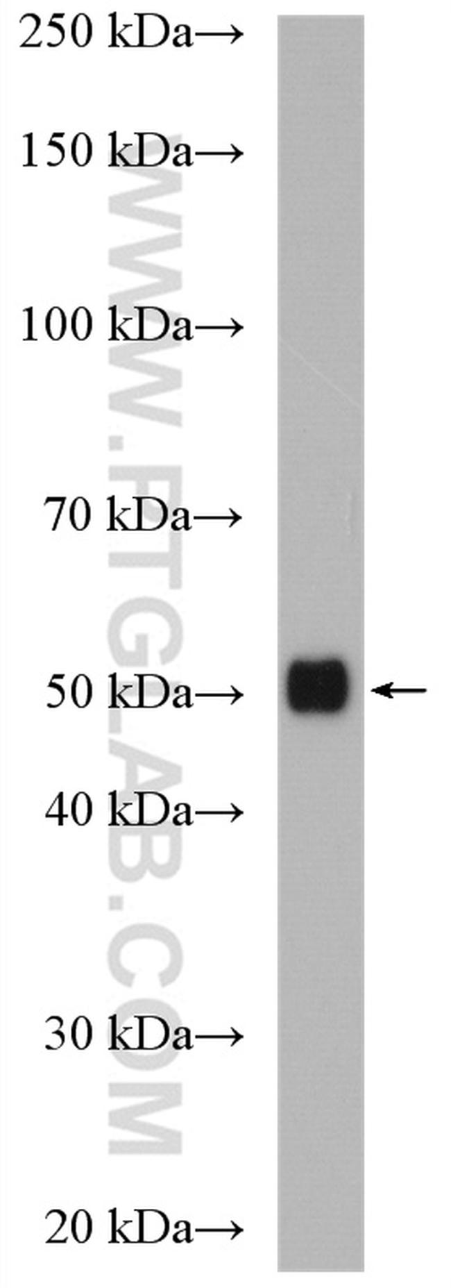 ZNHIT6 Antibody in Western Blot (WB)