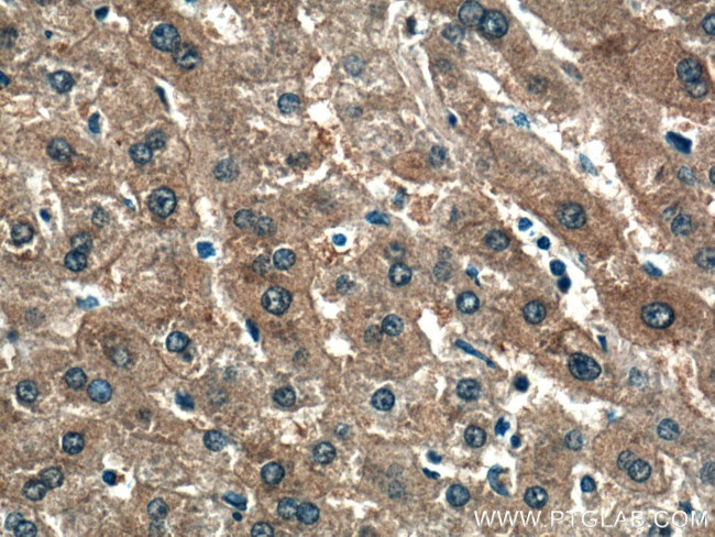NKPD1 Antibody in Immunohistochemistry (Paraffin) (IHC (P))