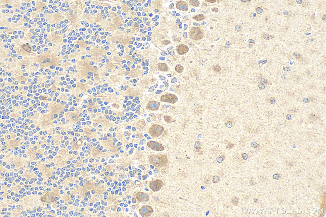 TMEM184B Antibody in Immunohistochemistry (Paraffin) (IHC (P))