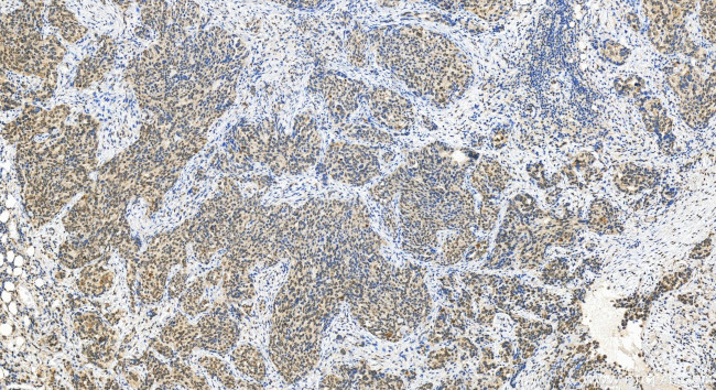 CLK3 Antibody in Immunohistochemistry (Paraffin) (IHC (P))