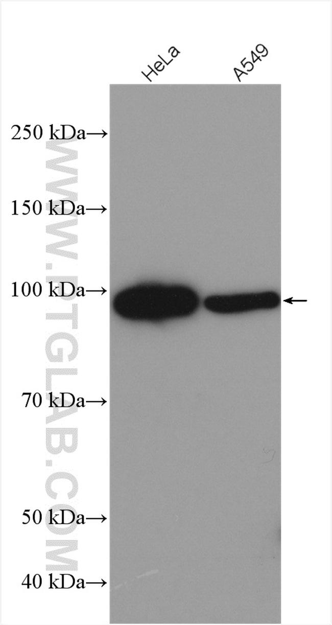 FBXO30 Antibody in Western Blot (WB)