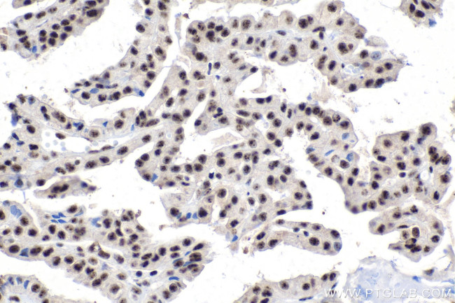 SON Antibody in Immunohistochemistry (Paraffin) (IHC (P))