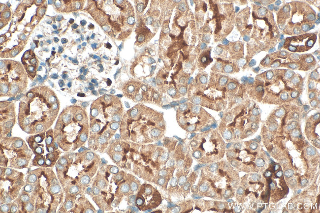TMEM72 Antibody in Immunohistochemistry (Paraffin) (IHC (P))