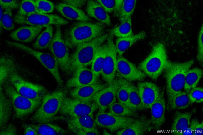 KPNA3 Antibody in Immunocytochemistry (ICC/IF)