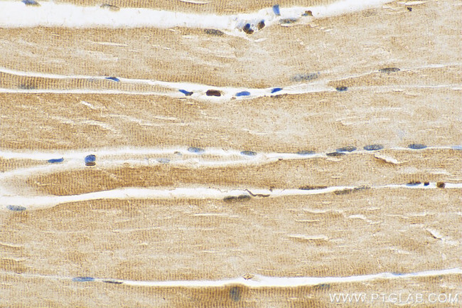 LRRC2 Antibody in Immunohistochemistry (Paraffin) (IHC (P))