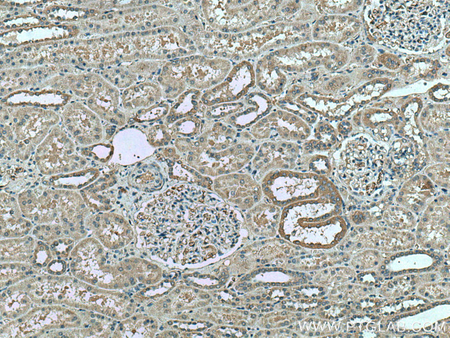 FAM135B Antibody in Immunohistochemistry (Paraffin) (IHC (P))