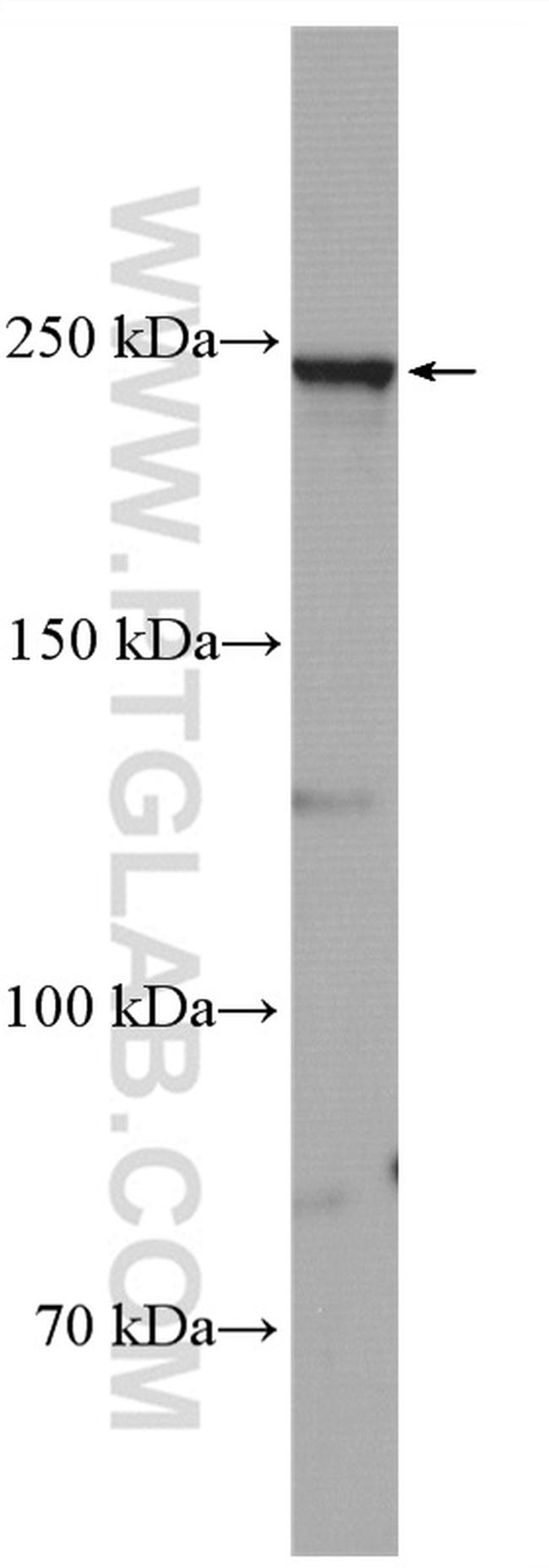 SCN1A Antibody in Western Blot (WB)